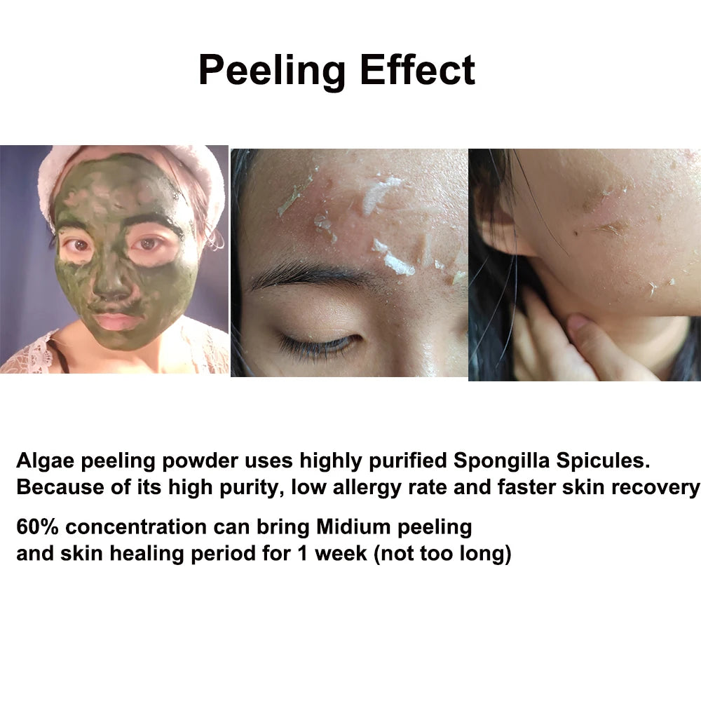 Algae Peel Family Herbal Sponge Combo Kit Hydrolyzed Spongilla Spicules Acne Remover Skin Whitening Suero Para De Algas Marinas